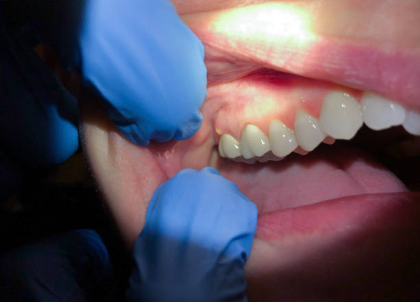 Best Pediatric Emergency Dentist in Forney, TX