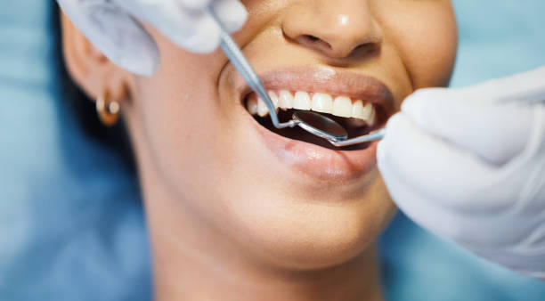 Best Emergency Tooth Extraction in Forney, TX